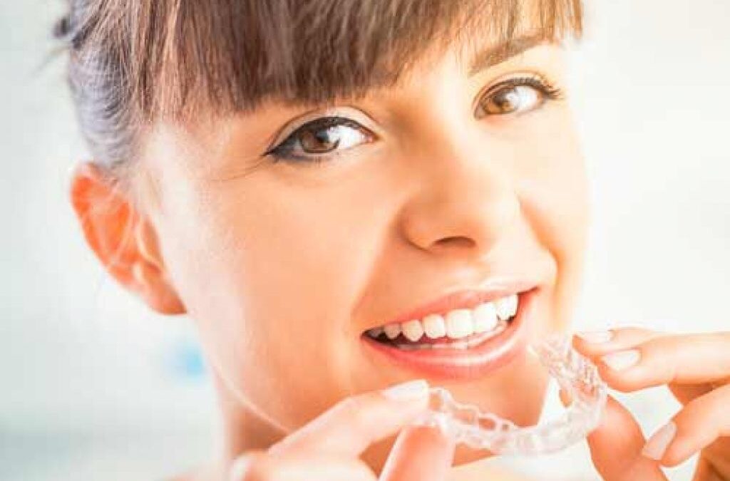 Ortodonzia a Verona: vantaggi apparecchio invisibile