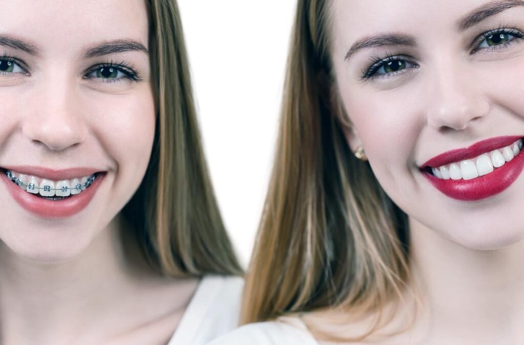 Non si vede, non si tocca e non si sente: è l’apparecchio trasparente!