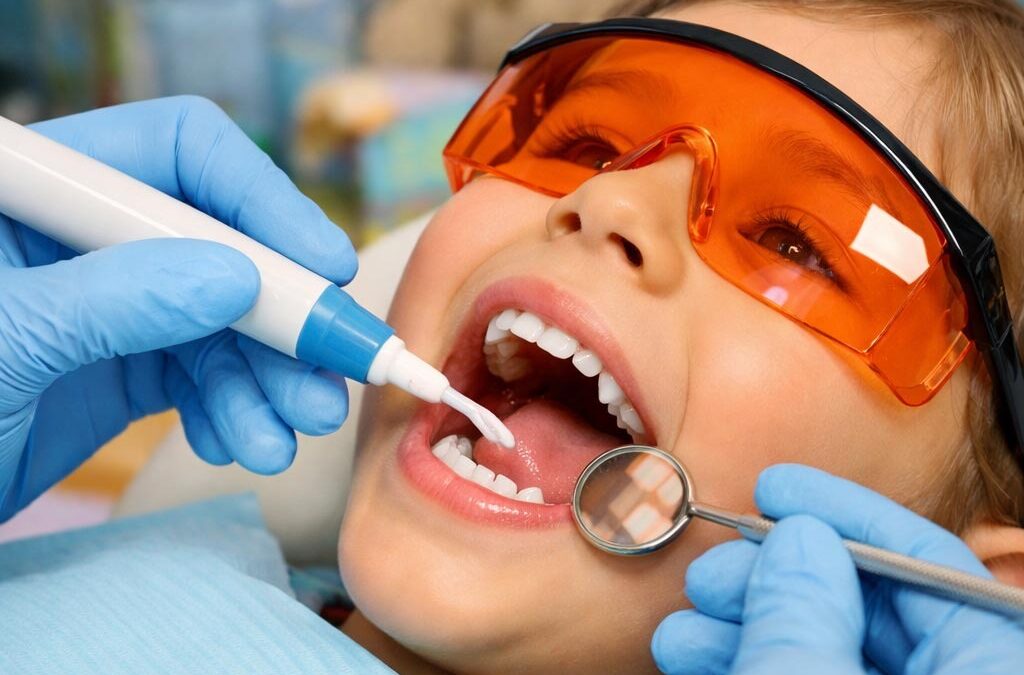 Sigillature dei primi molari permanenti